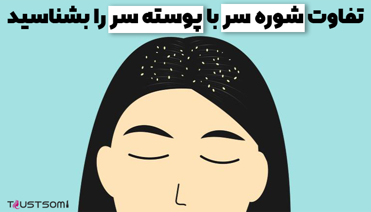 تفاوت شوره سر و پوسته سر