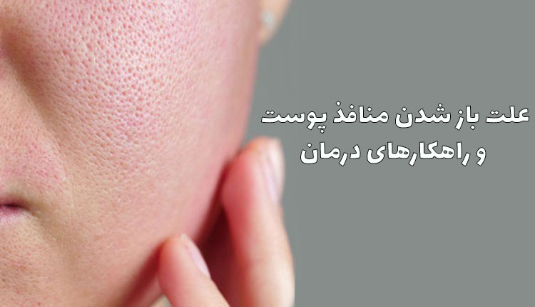 منافذ پوست
