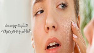 تفاوت پوست خشک و پوست دهیدراته