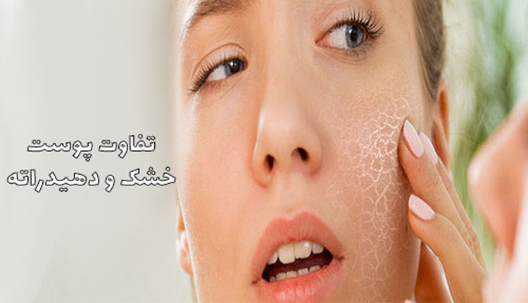 تفاوت پوست خشک و پوست دهیدراته